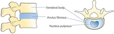Unraveling the mechanisms of intervertebral disc degeneration: an exploration of the p38 MAPK signaling pathway